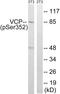 Valosin Containing Protein antibody, PA5-39821, Invitrogen Antibodies, Western Blot image 