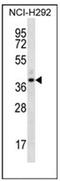 Olfactory Receptor Family 5 Subfamily I Member 1 antibody, AP53092PU-N, Origene, Western Blot image 
