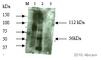 Inhibin Subunit Beta B antibody, ab89307, Abcam, Western Blot image 