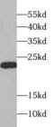 Sorcin antibody, FNab08228, FineTest, Western Blot image 