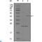 EPH Receptor A8 antibody, LS-C812456, Lifespan Biosciences, Western Blot image 