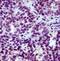 Thyroid Hormone Receptor Beta antibody, GTX17898, GeneTex, Immunohistochemistry paraffin image 