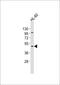 Sulfotransferase Hlo antibody, A10456-1, Boster Biological Technology, Western Blot image 