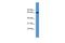 Insulin Like Growth Factor 2 MRNA Binding Protein 3 antibody, GTX49088, GeneTex, Western Blot image 