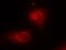 NFKB Inhibitor Alpha antibody, GTX50468, GeneTex, Immunocytochemistry image 