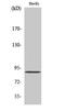 Calcium-independent phospholipase A2-gamma antibody, STJ93748, St John