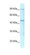 Gamma-Aminobutyric Acid Type A Receptor Pi Subunit antibody, PA5-46830, Invitrogen Antibodies, Western Blot image 