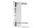 Colony Stimulating Factor 1 Receptor antibody, 3155S, Cell Signaling Technology, Western Blot image 