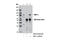 HNF1 Homeobox A antibody, 12425S, Cell Signaling Technology, Immunoprecipitation image 