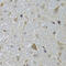 Chimerin 1 antibody, 23-019, ProSci, Immunohistochemistry paraffin image 