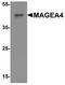 MAGE Family Member A4 antibody, PA5-72867, Invitrogen Antibodies, Western Blot image 
