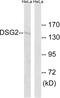 Desmoglein 2 antibody, LS-C119902, Lifespan Biosciences, Western Blot image 