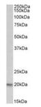 Proteasome Subunit Beta 9 antibody, orb125048, Biorbyt, Western Blot image 