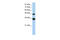 General Transcription Factor IIH Subunit 4 antibody, 28-777, ProSci, Western Blot image 