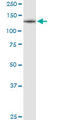 Colony Stimulating Factor 1 Receptor antibody, LS-C196979, Lifespan Biosciences, Western Blot image 
