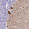 Nknb antibody, HPA045919, Atlas Antibodies, Immunohistochemistry frozen image 