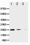 TNF Superfamily Member 10 antibody, PA5-80165, Invitrogen Antibodies, Western Blot image 