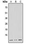 NADH:Ubiquinone Oxidoreductase Subunit B1 antibody, GTX56109, GeneTex, Western Blot image 