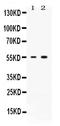 Activin A Receptor Type 2B antibody, PB9975, Boster Biological Technology, Western Blot image 