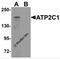 ATPase Secretory Pathway Ca2+ Transporting 1 antibody, 6287, ProSci, Western Blot image 