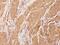 Actin Alpha 2, Smooth Muscle antibody, MBS438064, MyBioSource, Immunohistochemistry paraffin image 