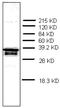 Prothymosin Alpha antibody, AM32975PU-N, Origene, Western Blot image 