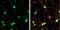 Synaptosome Associated Protein 23 antibody, NBP1-32694, Novus Biologicals, Immunocytochemistry image 