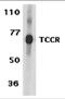 Interleukin 27 Receptor Subunit Alpha antibody, 2481, ProSci Inc, Western Blot image 