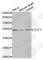 Transcription Factor 7 antibody, A3091, ABclonal Technology, Western Blot image 