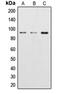 Catenin Beta 1 antibody, orb213801, Biorbyt, Western Blot image 