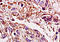 High Mobility Group AT-Hook 2 antibody, 251205, Abbiotec, Immunohistochemistry paraffin image 