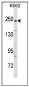 Kinase D Interacting Substrate 220 antibody, AP52362PU-N, Origene, Western Blot image 