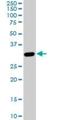 Phosphoribosyl Pyrophosphate Synthetase 1 Like 1 antibody, H00221823-M01, Novus Biologicals, Western Blot image 