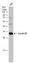 Cyclin D2 antibody, GTX133418, GeneTex, Western Blot image 