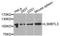 L3MBTL Histone Methyl-Lysine Binding Protein 3 antibody, A7289, ABclonal Technology, Western Blot image 