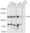 Aryl Hydrocarbon Receptor antibody, 15-576, ProSci, Western Blot image 