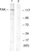 Protein Tyrosine Kinase 2 antibody, LS-B12417, Lifespan Biosciences, Western Blot image 