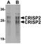 Cysteine Rich Secretory Protein 2 antibody, orb94568, Biorbyt, Western Blot image 