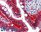 Galectin 3 antibody, LS-B9410, Lifespan Biosciences, Immunohistochemistry paraffin image 