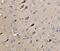 Autophagy Related 9A antibody, A03757-3, Boster Biological Technology, Immunohistochemistry paraffin image 