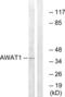 Acyl-CoA Wax Alcohol Acyltransferase 1 antibody, LS-C198664, Lifespan Biosciences, Western Blot image 