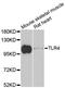 Toll Like Receptor 4 antibody, A11226, ABclonal Technology, Western Blot image 