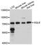 Squalene Epoxidase antibody, PA5-76523, Invitrogen Antibodies, Western Blot image 