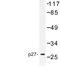 Cyclin Dependent Kinase Inhibitor 1B antibody, LS-C176691, Lifespan Biosciences, Western Blot image 