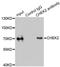 Checkpoint Kinase 2 antibody, LS-C746740, Lifespan Biosciences, Immunoprecipitation image 