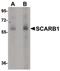 Scavenger Receptor Class B Member 1 antibody, PA5-20756, Invitrogen Antibodies, Western Blot image 
