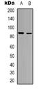 Fibroblast Growth Factor Receptor Substrate 2 antibody, abx133570, Abbexa, Western Blot image 