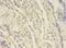 UDP-GlcNAc:betaGal beta-1,3-N-acetylglucosaminyltransferase 5 antibody, LS-C369310, Lifespan Biosciences, Immunohistochemistry frozen image 