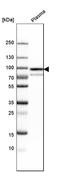 Protein S antibody, HPA007724, Atlas Antibodies, Western Blot image 