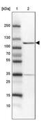 Myosin IG antibody, PA5-54363, Invitrogen Antibodies, Western Blot image 